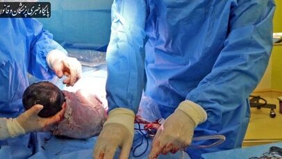 مرگ دو مادر باردار در ایلام زیر ذره‌بین وزارت بهداشت