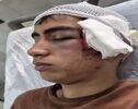 پرونده تنبیه بدنی دانش‌آموز دهبکری به جریان افتاد